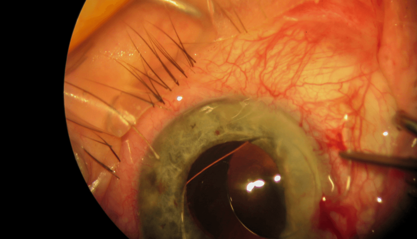 Surgical Co-Management Services